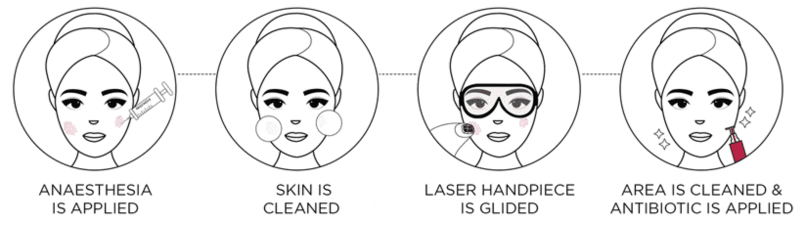 skin-resurfacing-process
