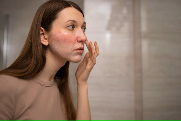 Dry skin face