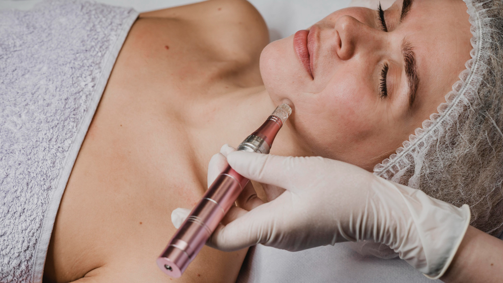 how to remove chicken pox marks